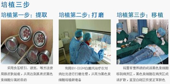 �������Ʒ���