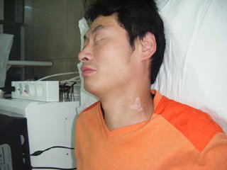 成都治疗白殿博润预约