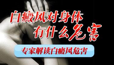 白癜风疾病的危害都有什么